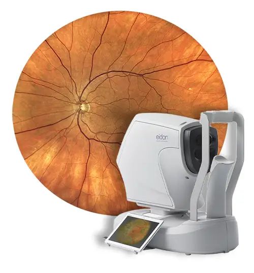 Eidon fundus camera and a fundus photo in the background