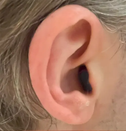 Signia - virtually invisible hearing aids